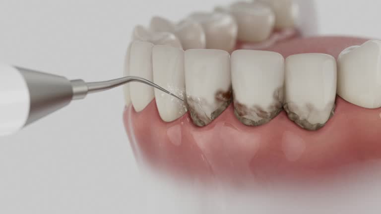 Reliable Dental contractor in Washington Court House, OH by Dentist Open Now